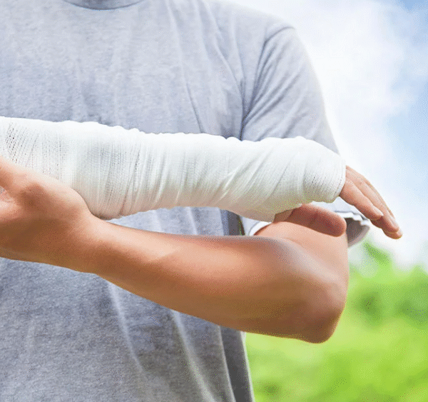 Personal Injury Lawyer in Houston, Texas: Truck Accident Injury Recovery Explained